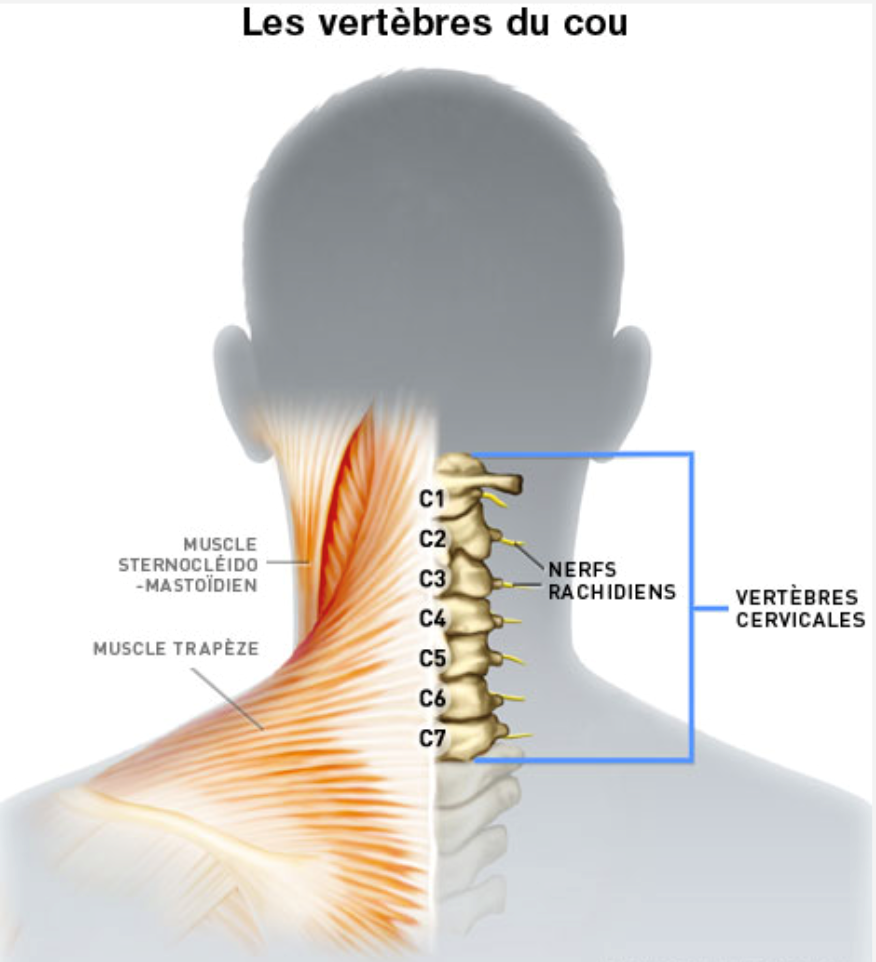 Canal cervical étroit - Chirurgie Orthopédique