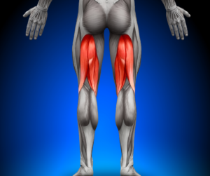 Rupture proximale des ischio-jambiers